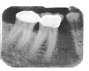 toothg-l.gif (13044 bytes)
